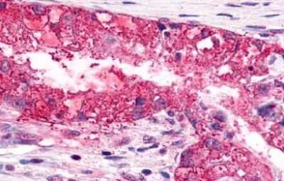 Immunohistochemistry-Paraffin: CXCR6 Antibody - BSA Free [NLS1102]