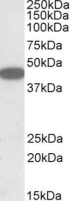 Western Blot: CXCR6 Antibody [NBP1-52034]