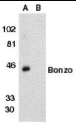 Western Blot: CXCR6 Antibody Blocking Peptide [NBP1-76871PEP]