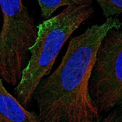 Immunocytochemistry/ Immunofluorescence: CXCR7/RDC-1 Antibody [NBP2-58162]