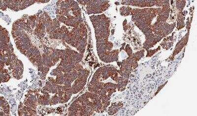 Immunohistochemistry-Paraffin: CXCR7/RDC-1 Antibody [NBP1-31309]