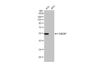 Western Blot: CXCR7/RDC-1 Antibody [NBP1-31309]