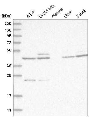 Western Blot: CXCR7/RDC-1 Antibody [NBP2-58162]