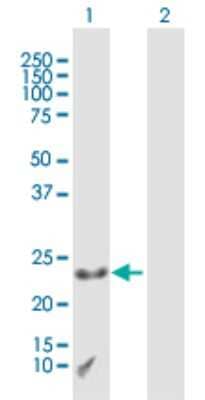 Western Blot: CXX1 Antibody [H00008933-B01P]