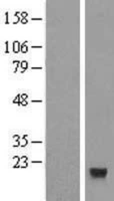 Western Blot: CXX1 Overexpression Lysate [NBL1-10465]