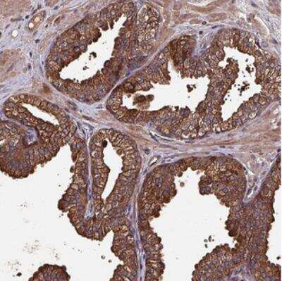 Immunohistochemistry: CXXC Finger Protein 11 Antibody [NBP2-31015]