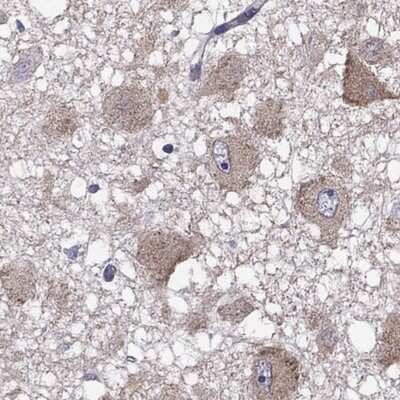 Immunohistochemistry-Paraffin: CXXC Finger Protein 11 Antibody [NBP2-31015]