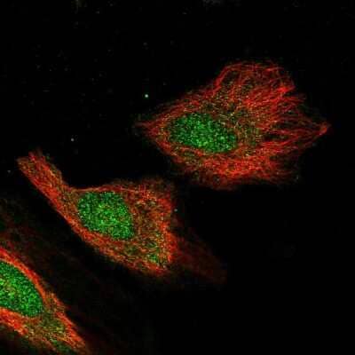 Immunocytochemistry/ Immunofluorescence: CXXC1 Antibody [NBP1-91816]