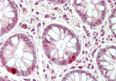 Immunohistochemistry-Paraffin: CXXC1 Antibody [NBP2-84739]