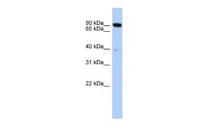 Western Blot: CXXC1 Antibody [NBP2-84739]