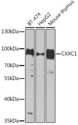 Western Blot: CXXC1 AntibodyBSA Free [NBP2-92690]