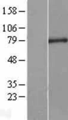 Western Blot: CXXC1 Overexpression Lysate [NBL1-09648]