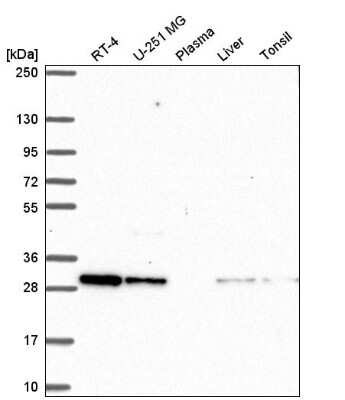 Western Blot: CXXC5 Antibody [NBP2-58775]