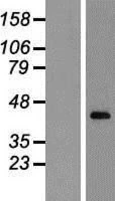 Western Blot: CXXC5 Overexpression Lysate [NBP2-07032]