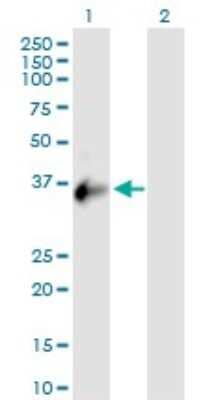 Western Blot: CXorf21 Antibody [H00080231-B01P]