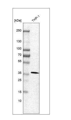 Western Blot: CXorf21 Antibody [NBP1-82317]