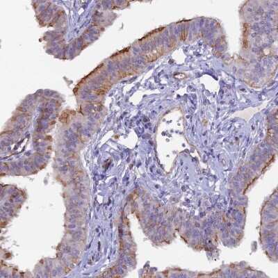 Immunohistochemistry-Paraffin: CXorf22 Antibody [NBP1-93481]