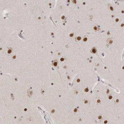 Immunohistochemistry-Paraffin: BCLAF3 Antibody [NBP1-86397]