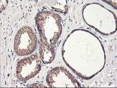 Immunohistochemistry-Paraffin: PBDC1 Antibody (OTI4E11) [NBP2-00929]