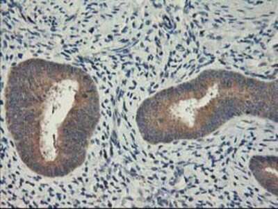 Immunohistochemistry-Paraffin: PBDC1 Antibody (OTI4E11) [NBP2-00929]