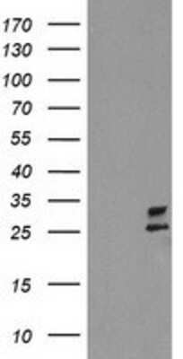 Western Blot: PBDC1 Antibody (OTI4E11) [NBP2-00929]