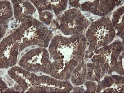 Immunohistochemistry: PBDC1 Antibody (OTI5A11) [NBP2-46410]
