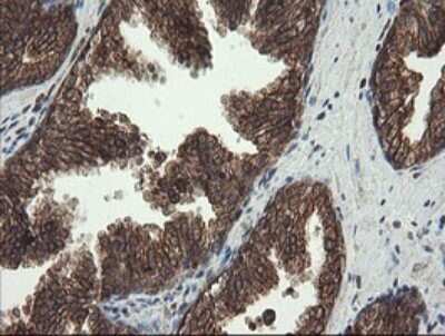 Immunohistochemistry: PBDC1 Antibody (OTI5A11) [NBP2-46410]