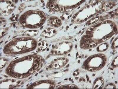 Immunohistochemistry: PBDC1 Antibody (OTI5A11) [NBP2-46410]