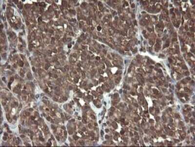 Immunohistochemistry: PBDC1 Antibody (OTI5A11) [NBP2-46410]