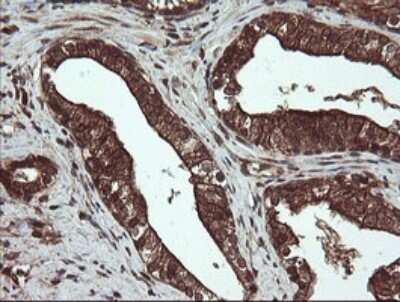 Immunohistochemistry: PBDC1 Antibody (OTI5A11) [NBP2-46410]