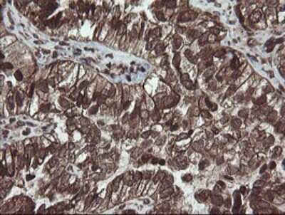 Immunohistochemistry: PBDC1 Antibody (OTI5A11) [NBP2-46410]