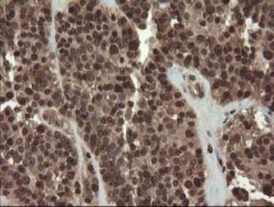 Immunohistochemistry: PBDC1 Antibody (OTI5A11) [NBP2-46410]
