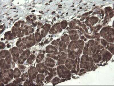 Immunohistochemistry: PBDC1 Antibody (OTI5A11) [NBP2-46410]