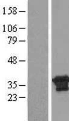 Western Blot: PBDC1 Overexpression Lysate [NBL1-09639]