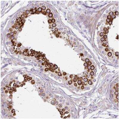 Immunohistochemistry: CXorf22 Antibody [NBP2-30729]