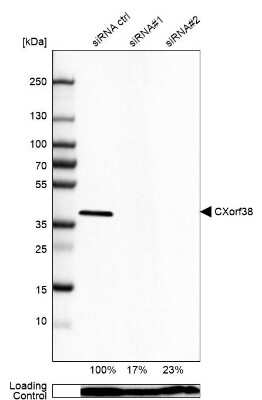 Western Blot: CXorf38 Antibody [NBP2-14705]