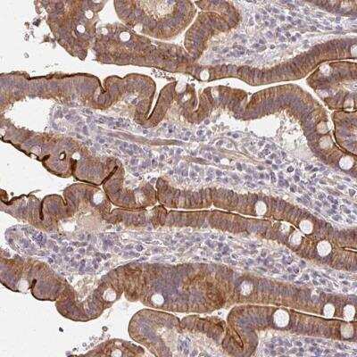 Immunohistochemistry-Paraffin: CXorf40A Antibody [NBP2-46859]