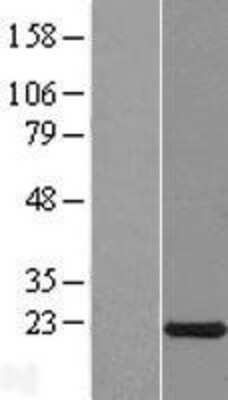 Western Blot: CXorf40A Overexpression Lysate [NBL1-09642]