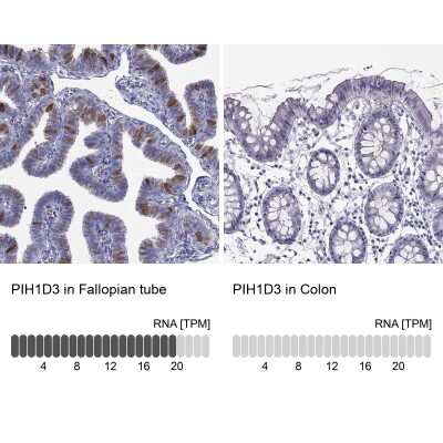 Immunohistochemistry-Paraffin: PIH1D3 Antibody [NBP2-62677]