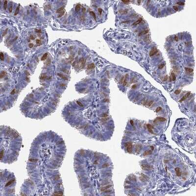 Immunohistochemistry-Paraffin: PIH1D3 Antibody [NBP2-62677]