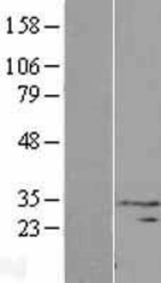 Western Blot: PIH1D3 Overexpression Lysate [NBL1-09643]