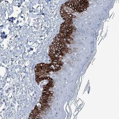 Immunohistochemistry-Paraffin: CXorf56/MRX107 Antibody [NBP1-82097]