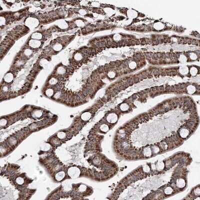 Immunohistochemistry-Paraffin: CXorf56/MRX107 Antibody [NBP1-82098]