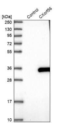 Western Blot: CXorf56/MRX107 Antibody [NBP1-82097]