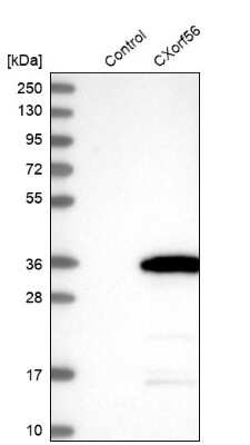 Western Blot: CXorf56/MRX107 Antibody [NBP1-82098]