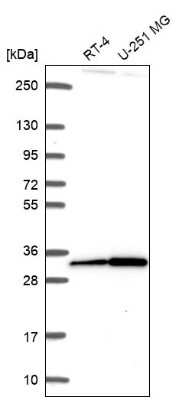 Western Blot: CXorf56/MRX107 Antibody [NBP2-57638]