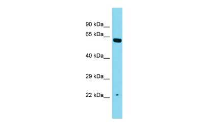 Western Blot: CXorf56/MRX107 Antibody [NBP3-10720]