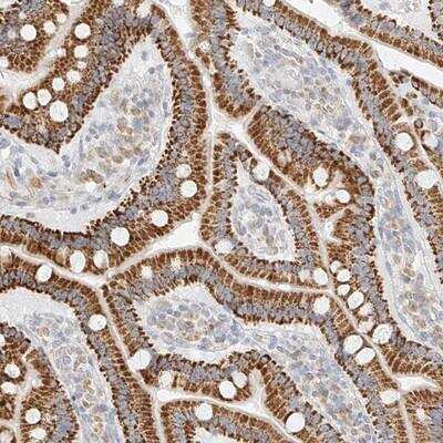 Immunohistochemistry-Paraffin: CXorf58 Antibody [NBP1-93910]