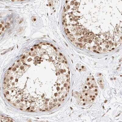 Immunohistochemistry-Paraffin: CXorf58 Antibody [NBP2-48613]