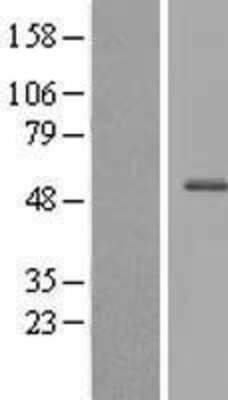 Western Blot: CXorf22 Overexpression Lysate [NBL1-09646]